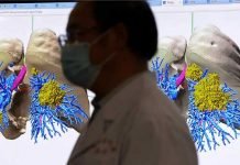Coronavirus: country comparisons are pointless unless we account for these biases in testing