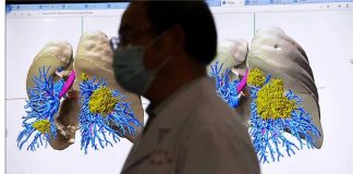 Coronavirus: country comparisons are pointless unless we account for these biases in testing